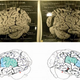 Illustration for article titled Einsteins brain was definitely not like the others, scientists say